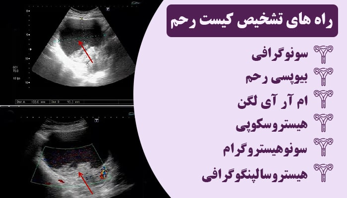 از کجا بفهمم کیست رحم دارم