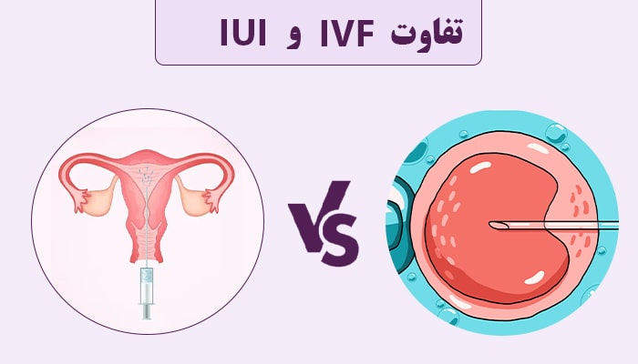 تفاوت بین ivf و iui