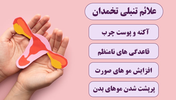 علائم تنبلی تخمدان