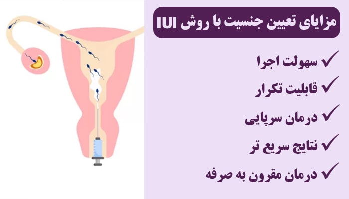 مزایای تعیین جنسیت با روش IUI