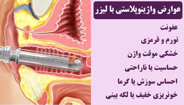 عوارض واژینوپلاستی با لیزر