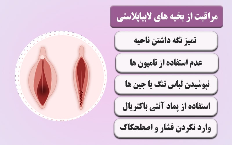 روش های مراقبت از بخیه های لابیاپلاستی