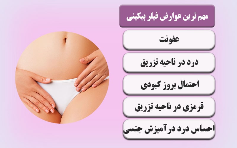 تزریق ژل به واژن چگونه انجام می‌شود+چه فیلری برای بیکینی خوبه+ژل تنگ کننده واژن