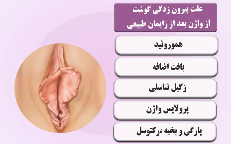 عکس توده سفت زیر پوست در ناحیه تناسلی زنان