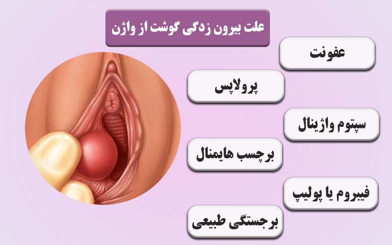 عکس زخم بیرونی واژن