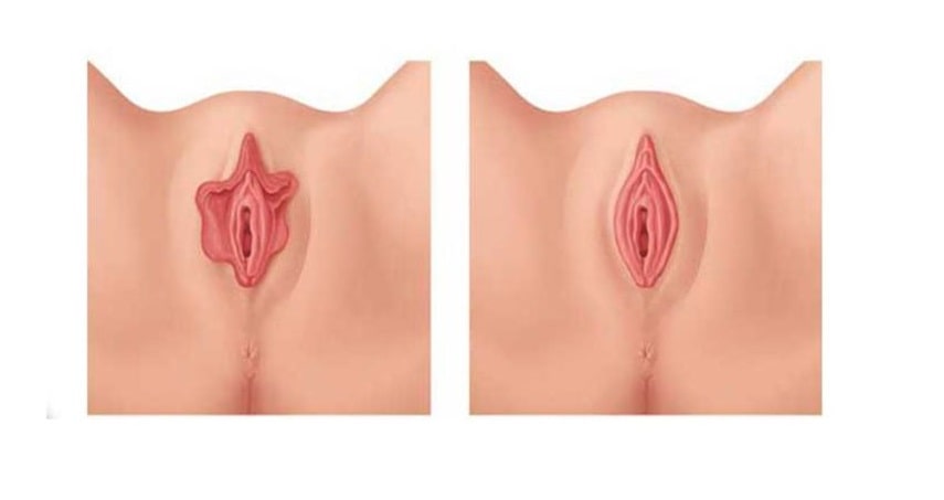 مچ پا چه ربطی به واژن دارد؟