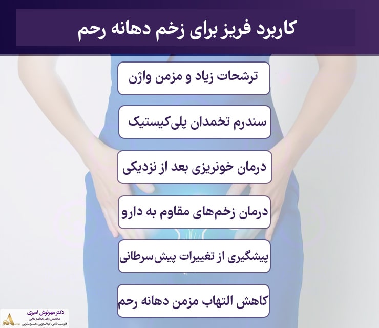 مراقبت های بعد از فریز زخم دهانه رحم