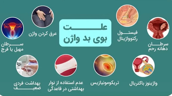 از بین بردن بوی بد واژن سریع [علت + درمان بوی بد واژن]