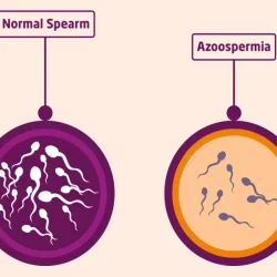 آزواسپرمی چیست